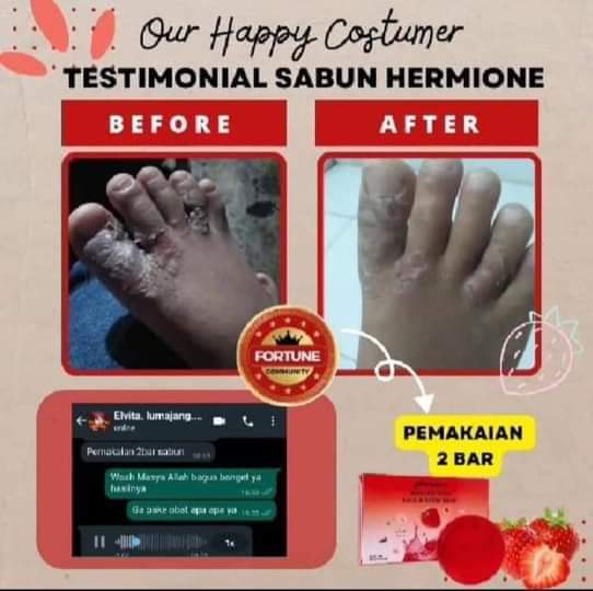 Testi-Hermione-Eksim-Kaki
